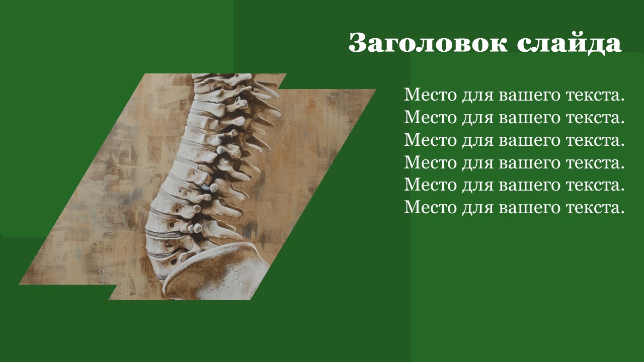 Презентация Опорные системы 